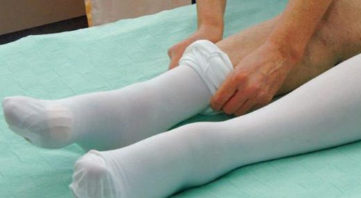 Why Is It Recommended to Wear Compression Stockings After Surgery?