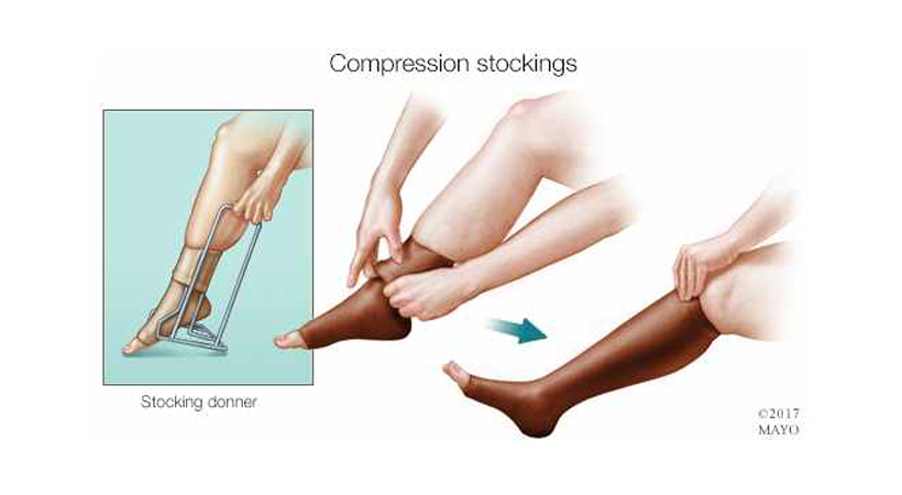 How – To Put On – Compression Stockings