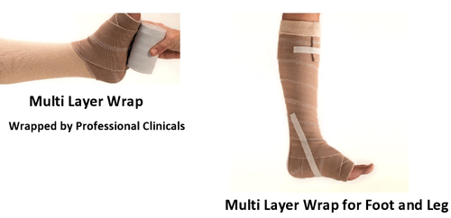 Multi-Layer-Leg-Wrap is used for many reasons including to improve leg circulation and help any improve leg wound healing.